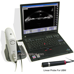 Ultrasound Biomicroscopy(UBM)
